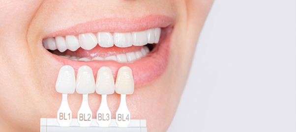 How to Take Care of Your Porcelain Veneers?