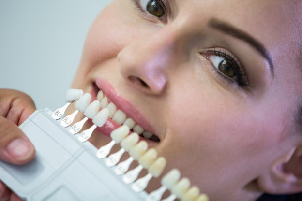 Are Dental Veneers Right for You? Pros and Cons Explained