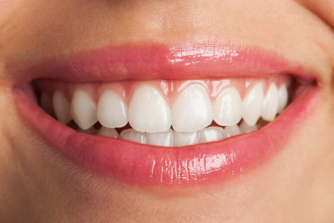 Whitened Teeth Without Sensitivity: Yes, It’s Possible!