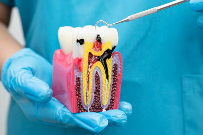 How Modern Endodontics Enhances Smile Confidence